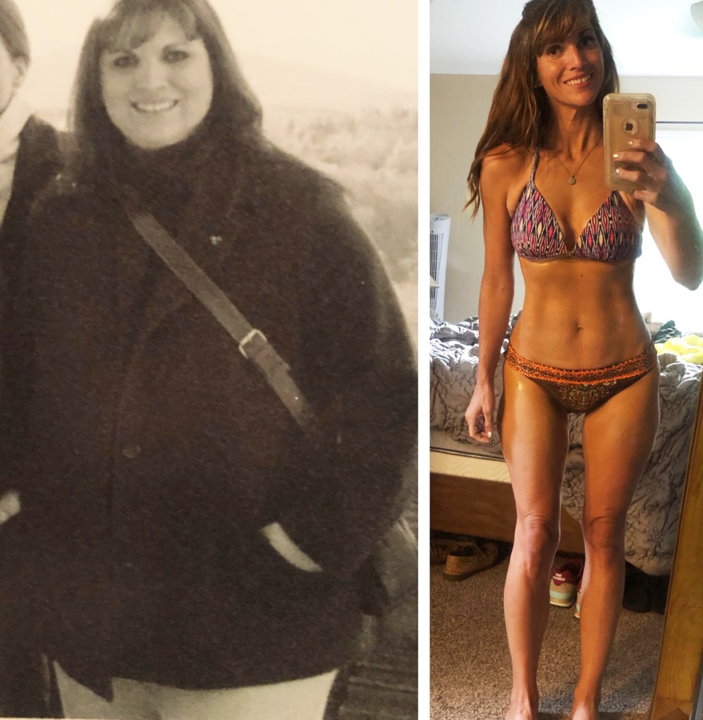 before after weight loss photo of woman