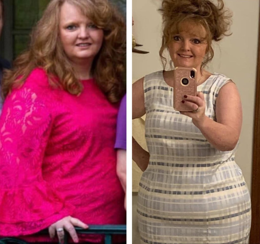 woman side by side weight loss