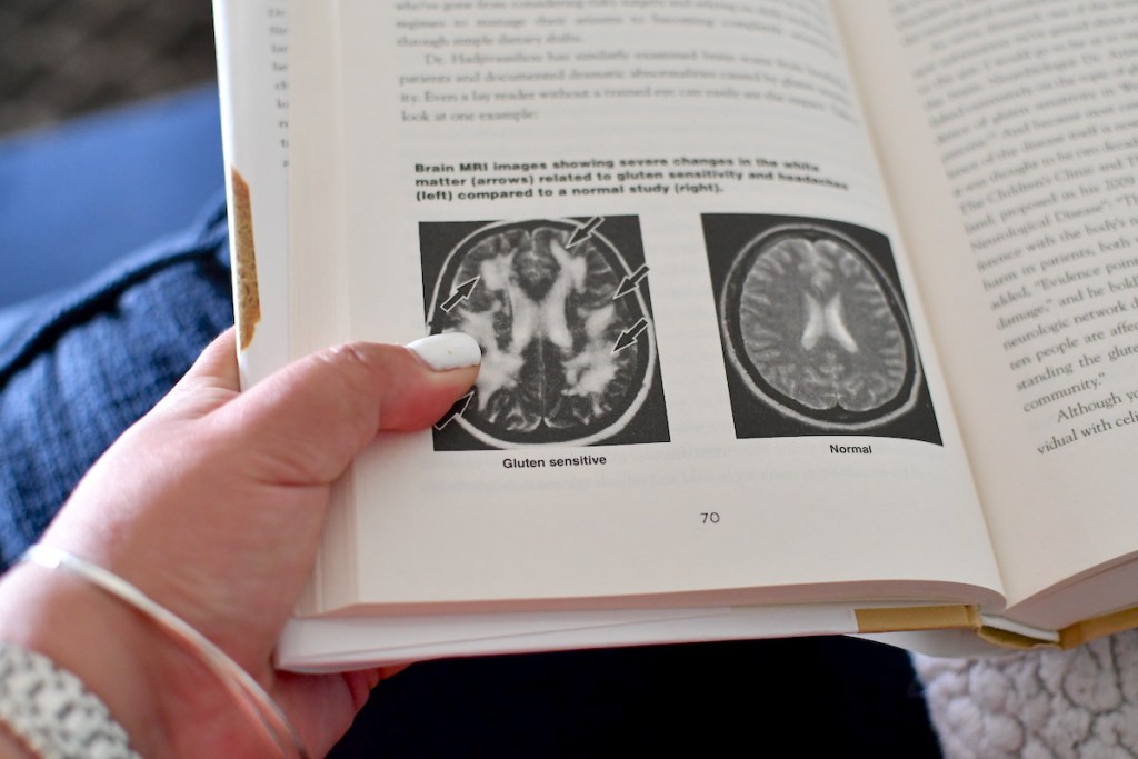 hand holding a book open with pictures of brain