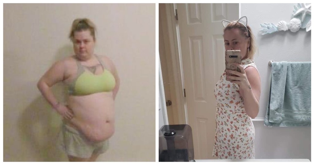 woman in side-by-side before and after weight loss photos