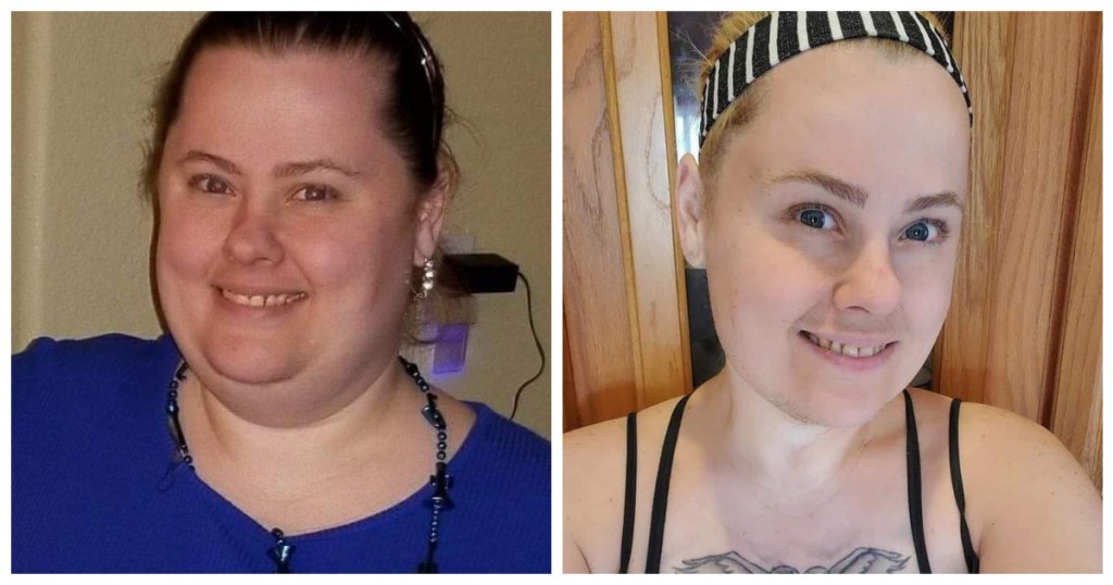 side-by-side photo of woman before and after weight loss