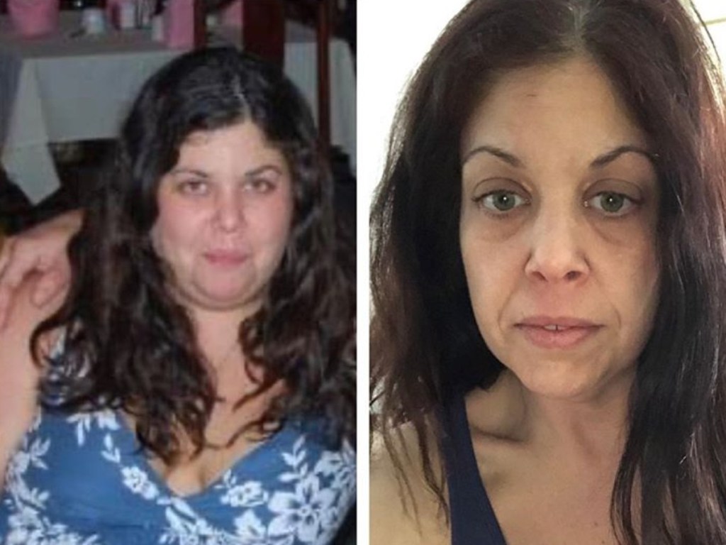 woman before and after weight loss