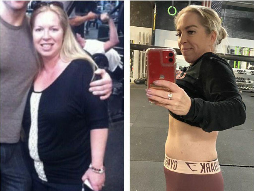 woman in side by side weight loss pics