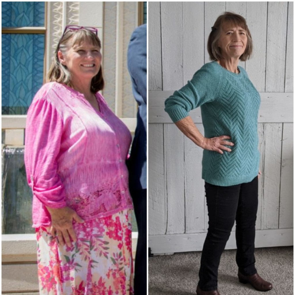 woman before and after weight loss of keto diet success